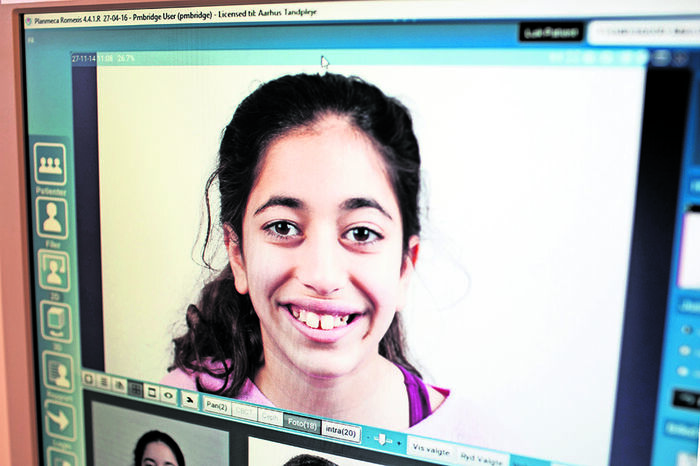 Tandklinikken har stadig fotos af Marta fra dengang, hun begyndte at få rettet tænder. På billedet er hun 11 år.